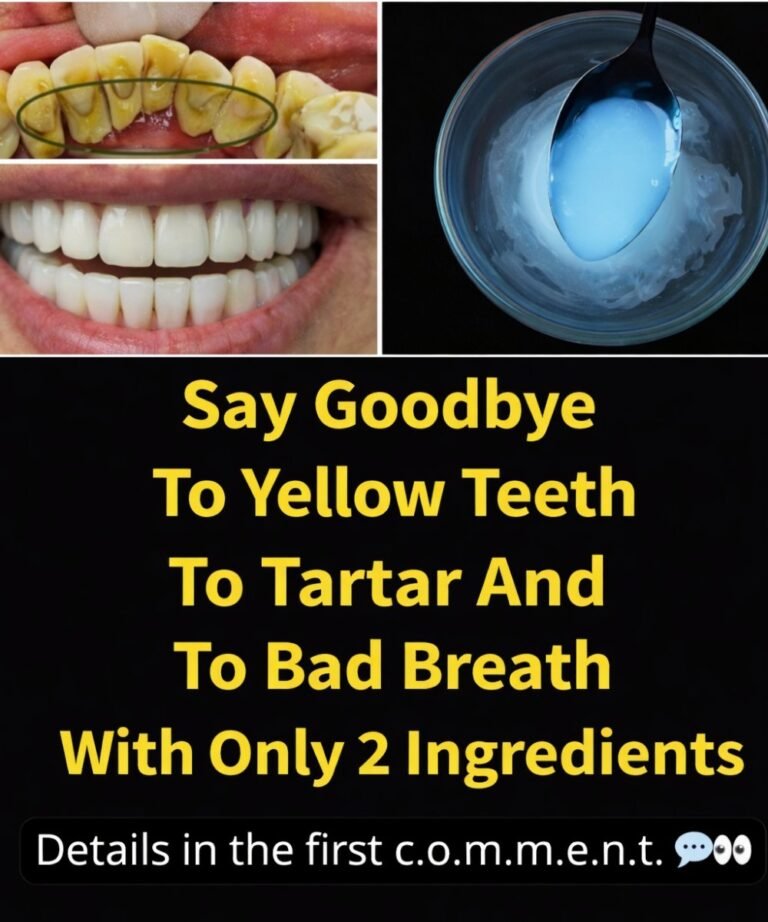 Say Goodbye to Yellow Teeth, Tartar, and Bad Breath With Only 2 Simple Ingredients