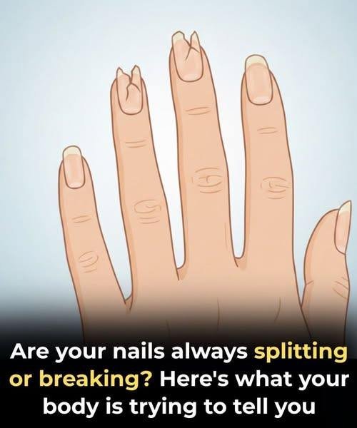 “Notice Nails Like This? Time to Get Checked”